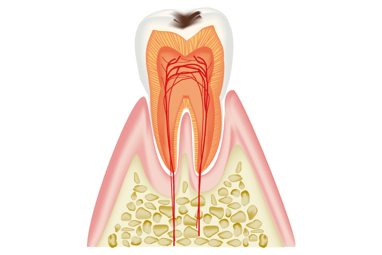 C1